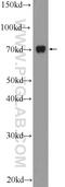 TGF-Beta Activated Kinase 1 (MAP3K7) Binding Protein 2 antibody, 14410-1-AP, Proteintech Group, Western Blot image 