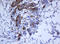 Keratin 5 antibody, LS-C175452, Lifespan Biosciences, Immunohistochemistry paraffin image 