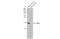 Cytochrome C Oxidase Subunit 4I1 antibody, GTX114330, GeneTex, Western Blot image 