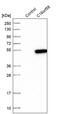 Chromosome 16 Open Reading Frame 58 antibody, PA5-55071, Invitrogen Antibodies, Western Blot image 