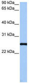 Centrosomal Protein 112 antibody, TA336010, Origene, Western Blot image 