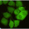 Cyclin Dependent Kinase 1 antibody, LS-C812909, Lifespan Biosciences, Immunocytochemistry image 