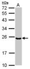 Ubiquitin Conjugating Enzyme E2 T antibody, NBP2-20789, Novus Biologicals, Western Blot image 