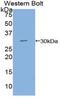 Diacylglycerol Kinase Gamma antibody, MBS2013107, MyBioSource, Western Blot image 