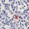 TNF Receptor Superfamily Member 8 antibody, LS-C88124, Lifespan Biosciences, Immunohistochemistry paraffin image 