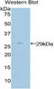 Pim-2 Proto-Oncogene, Serine/Threonine Kinase antibody, LS-C295925, Lifespan Biosciences, Western Blot image 