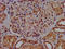 CTR1 antibody, LS-C670309, Lifespan Biosciences, Immunohistochemistry paraffin image 