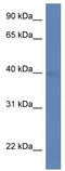 ADP Ribosylation Factor Interacting Protein 2 antibody, TA331996, Origene, Western Blot image 