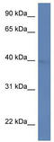 Arfaptin-2 antibody, TA331996, Origene, Western Blot image 