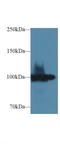 Ectonucleotide Pyrophosphatase/Phosphodiesterase 1 antibody, LS-C293726, Lifespan Biosciences, Western Blot image 