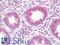 ADP Ribosylation Factor Interacting Protein 1 antibody, LS-B9709, Lifespan Biosciences, Immunohistochemistry paraffin image 