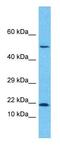 Growth Arrest And DNA Damage Inducible Beta antibody, GTX46244, GeneTex, Western Blot image 