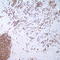Mucin 1, Cell Surface Associated antibody, TA327702, Origene, Immunohistochemistry frozen image 
