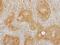 Inositol Polyphosphate-5-Phosphatase B antibody, LS-C186266, Lifespan Biosciences, Immunohistochemistry frozen image 