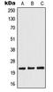 Twist Family BHLH Transcription Factor 1 antibody, LS-C352964, Lifespan Biosciences, Western Blot image 