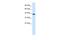 Zinc Finger Protein 670 antibody, A15392, Boster Biological Technology, Western Blot image 