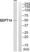 Septin 14 antibody, abx014846, Abbexa, Western Blot image 