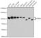 Poly(ADP-Ribose) Glycohydrolase antibody, GTX64691, GeneTex, Western Blot image 