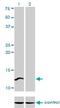 Cleavage Stimulation Factor Subunit 3 antibody, H00001479-M01, Novus Biologicals, Western Blot image 