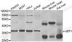 Activator Of Basal Transcription 1 antibody, A5898, ABclonal Technology, Western Blot image 