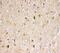 Prohibitin antibody, PA1932, Boster Biological Technology, Immunohistochemistry paraffin image 