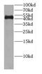 Centromere Protein L antibody, FNab01588, FineTest, Western Blot image 