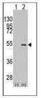 Elongator complex protein 3 antibody, AP11145PU-N, Origene, Western Blot image 