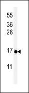 Peptide YY antibody, 61-793, ProSci, Western Blot image 