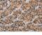 CD80 Molecule antibody, MBS2520147, MyBioSource, Immunohistochemistry paraffin image 