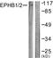 EPH Receptor B1 antibody, PA5-38481, Invitrogen Antibodies, Western Blot image 