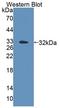 DNA Topoisomerase III Beta antibody, LS-C712758, Lifespan Biosciences, Western Blot image 