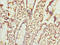 Zinc Finger Protein 169 antibody, LS-C676745, Lifespan Biosciences, Immunohistochemistry paraffin image 