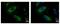 Protein Phosphatase, Mg2+/Mn2+ Dependent 1A antibody, PA5-29041, Invitrogen Antibodies, Immunofluorescence image 