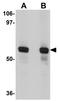 Sushi Repeat Containing Protein X-Linked 2 antibody, GTX31974, GeneTex, Western Blot image 