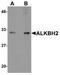 AlkB Homolog 2, Alpha-Ketoglutarate Dependent Dioxygenase antibody, A06325, Boster Biological Technology, Western Blot image 