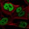 Transcription factor SOX-10 antibody, HPA068898, Atlas Antibodies, Immunofluorescence image 