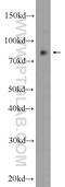 Protein Phosphatase 1 Regulatory Subunit 3F antibody, 55386-1-AP, Proteintech Group, Western Blot image 