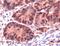 MutS Homolog 6 antibody, MA5-16381, Invitrogen Antibodies, Immunohistochemistry paraffin image 