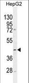 Trimethyllysine Hydroxylase, Epsilon antibody, LS-C162030, Lifespan Biosciences, Western Blot image 