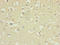 Interleukin-36 alpha antibody, LS-C675897, Lifespan Biosciences, Immunohistochemistry paraffin image 