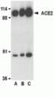Angiotensin I Converting Enzyme 2 antibody, TA306147, Origene, Western Blot image 