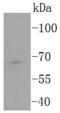 Transcription Factor 7 Like 2 antibody, A00431-1, Boster Biological Technology, Western Blot image 