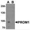Prominin-1 antibody, TA349049, Origene, Western Blot image 