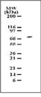 Interleukin 1 Receptor Associated Kinase 2 antibody, NB100-56363, Novus Biologicals, Western Blot image 