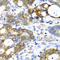 Amylase Alpha 2A (Pancreatic) antibody, A8045, ABclonal Technology, Immunohistochemistry paraffin image 