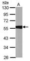 Aldehyde Dehydrogenase 1 Family Member A1 antibody, PA5-34623, Invitrogen Antibodies, Western Blot image 