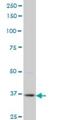 PDZ Binding Kinase antibody, H00055872-M07, Novus Biologicals, Western Blot image 