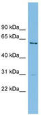 Cysteine And Serine Rich Nuclear Protein 1 antibody, TA344648, Origene, Western Blot image 