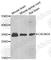 Calcium Voltage-Gated Channel Auxiliary Subunit Gamma 4 antibody, A7588, ABclonal Technology, Western Blot image 