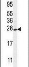 Crystallin Gamma S antibody, PA5-24230, Invitrogen Antibodies, Western Blot image 